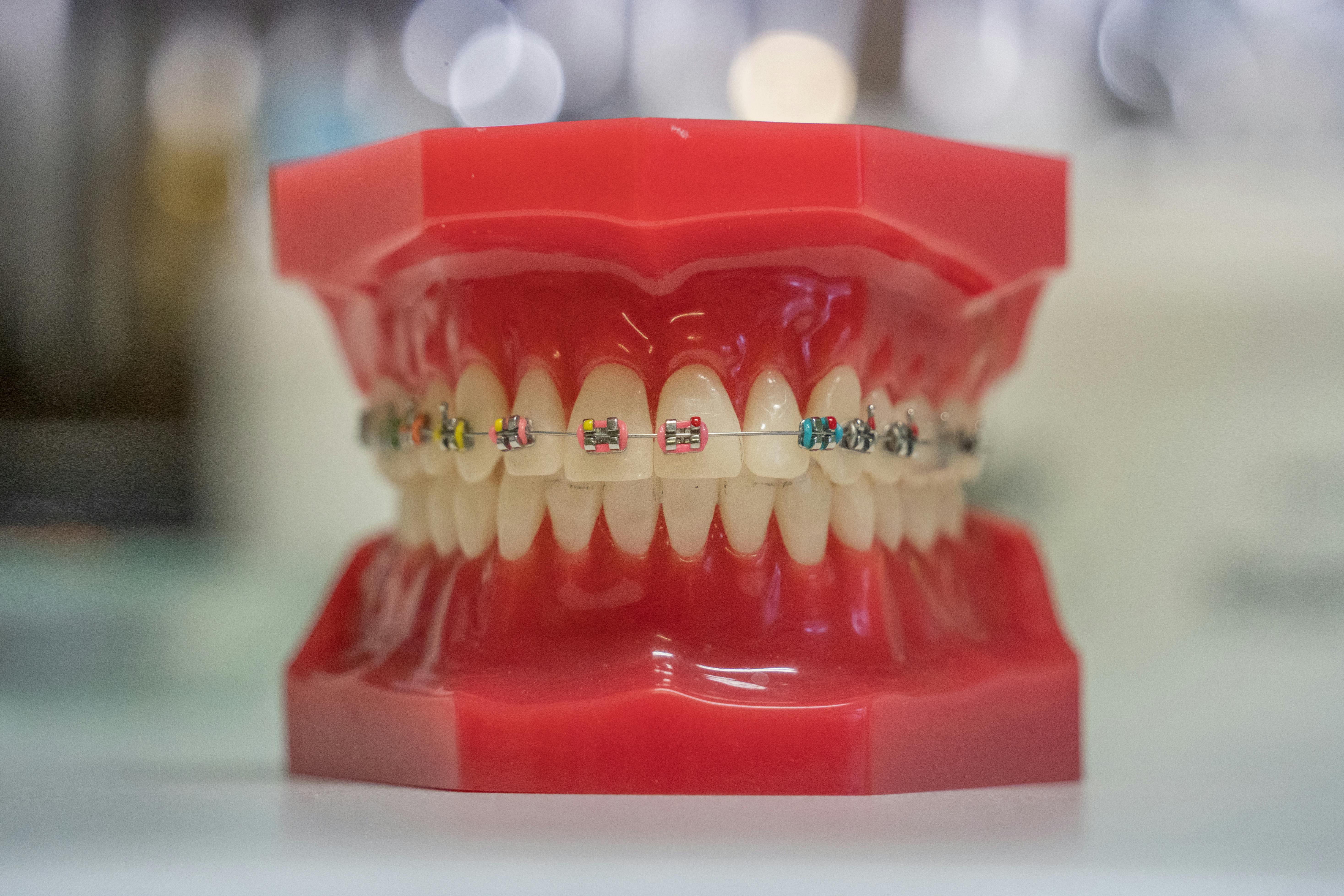 Orthodontic Treatment